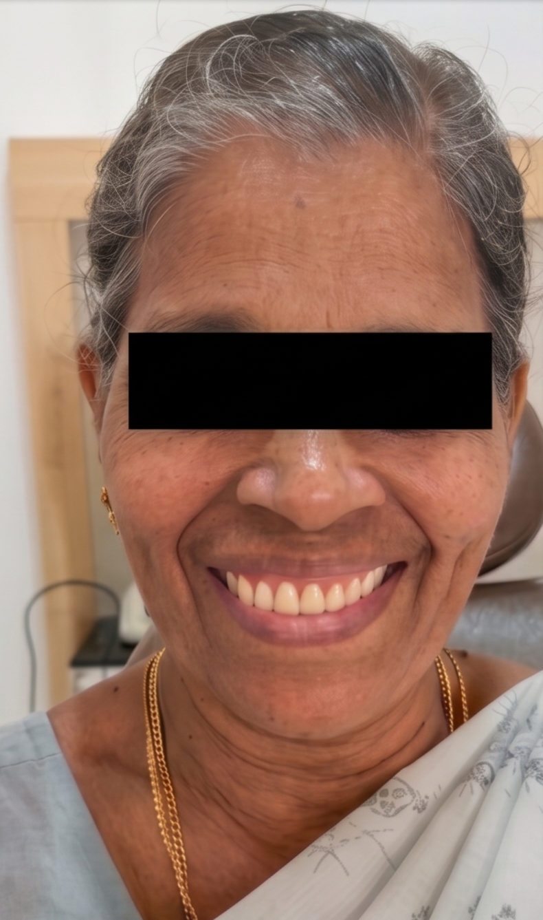 smile Before