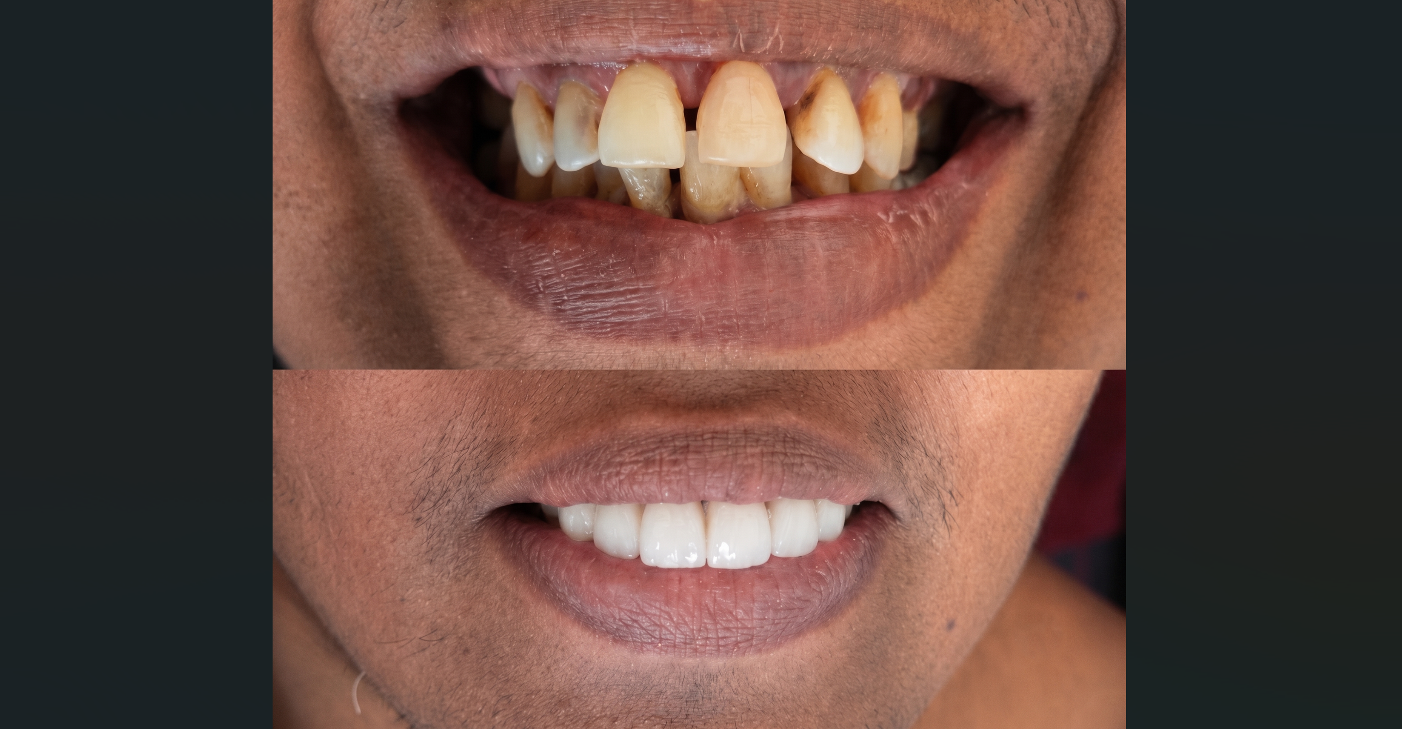 Smile designing and cosmetic dentistry in Velur, Thrissur